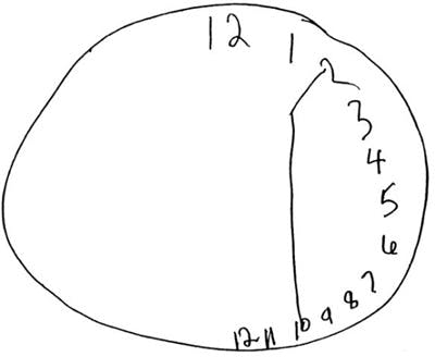 constructural apraxia after right side stroke