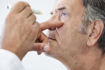 Hombre con problemas de visión que es un efecto secundario común de un derrame cerebral.