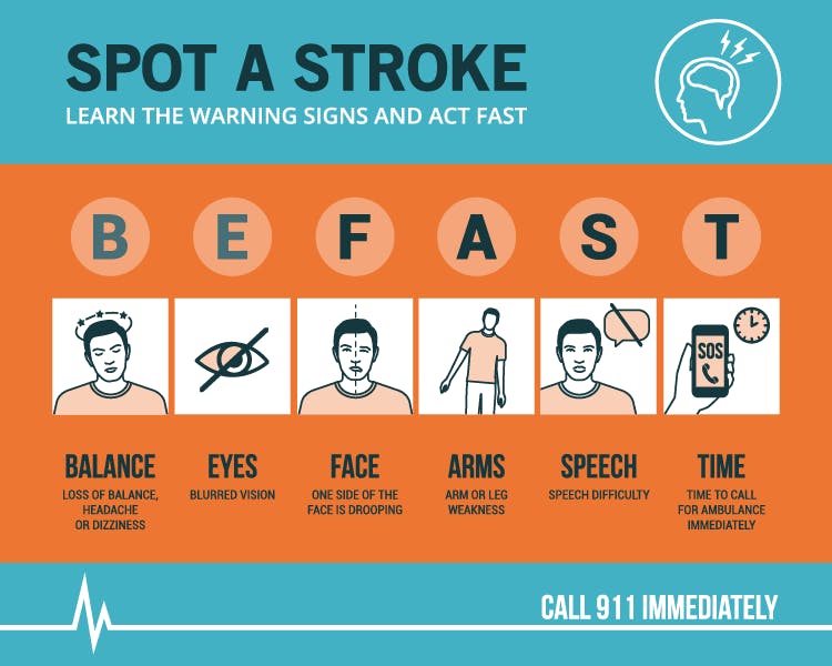 learn the signs of a stroke and what the fast acronym means