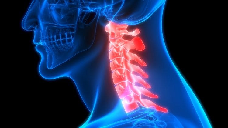 Cervical Spine Injury Causes And What To Expect Flint Rehab