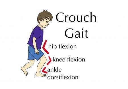 characteristics of crouch gait in boy with cerebral palsy