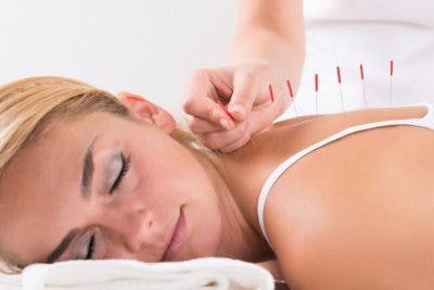 woman trying acupuncture for post-traumatic cervical dystonia