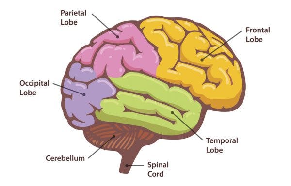 what is parietal lobe stroke