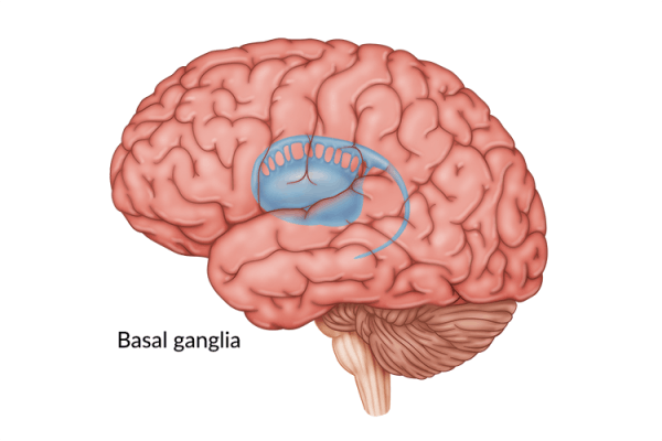 medical illustration of brain highlighting basal ganglia damage