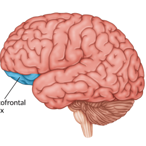 illustration of orbitofrontal cortex damage area in the brain