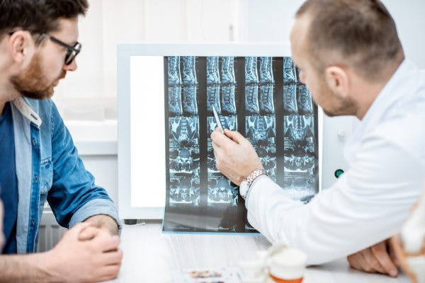 spinal cord injury scoliosis development