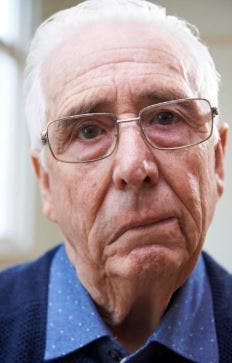 Mann zeigt Hirnstamm Schlaganfall Symptome des herabhängenden Gesichts