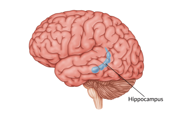 medical illustration of brain highlighting hippocampus damage