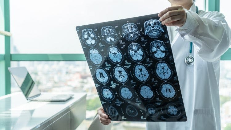Doctor sitting in office looking at MRI scans showing focal brain injuries