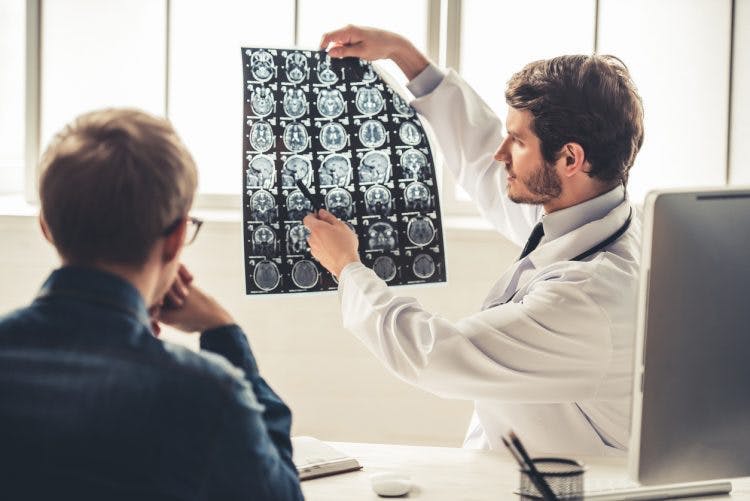 Der Neurologe hält Gehirnscans hoch, um zu diskutieren, warum Patienten nach einem Schlaganfall nicht sprechen können