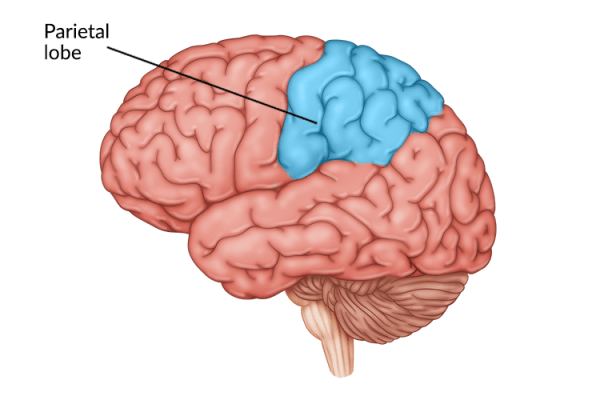 medical illustration of brain highlighting parietal lobe damage