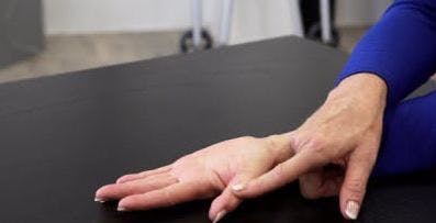 Ergotherapeut mit Handfläche auf dem Tisch für die Handtherapie