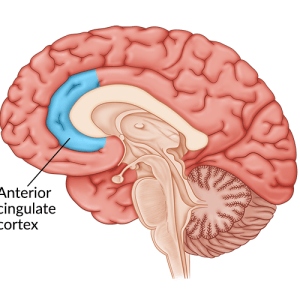 medical illustration of brain highlighting anterio cingulate cortex damage