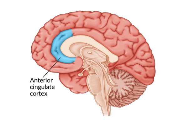 医疗插图的大脑突出anterio扣带皮层损伤