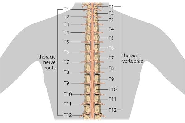 T6脊髓损伤神经和椎骨
