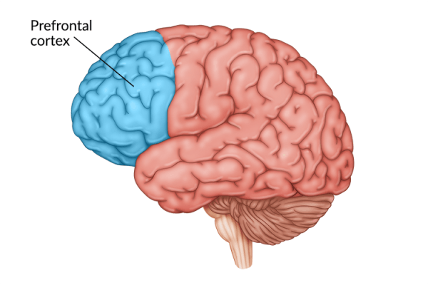 medical illustration of brain highlighting prefrontal cortex damage