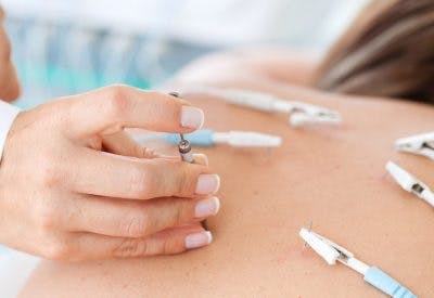 electroacupuncture treatment for spinal cord injury