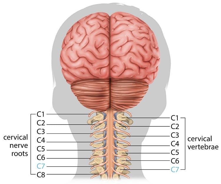 illustration of c7 spinal cord injury and vertebrae