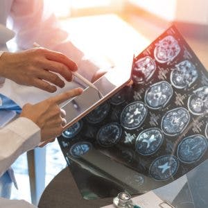 doctors looking at MRI that shows signs of mixed transcortical aphasia