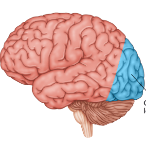 medical illustration of brain highlighting occipital lobe damage