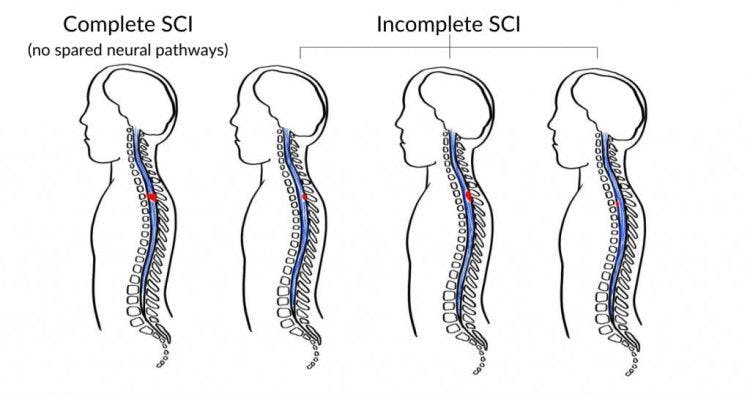 complete vs incomplete c3 sci