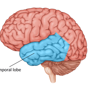 medical illustration of brain highlighting temporal lobe damage