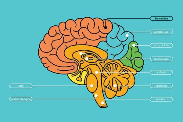colorida ilustración de la anatomía del cerebro destacando un ACV del lóbulo frontal