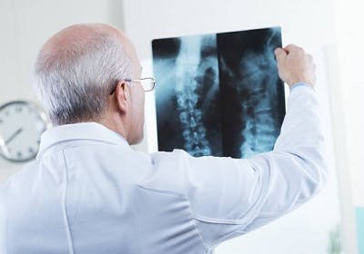 doctor looking at spinal cord xray to determine whether surgery is necessary