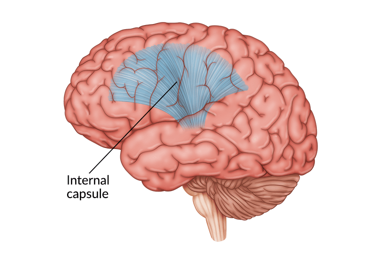 medical illustration of brain with internal capsule highlighted