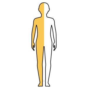 illustration of areas of the body affected by left hemiplegia