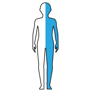 outline of body with right side highlighted to illustrate right hemiplegia