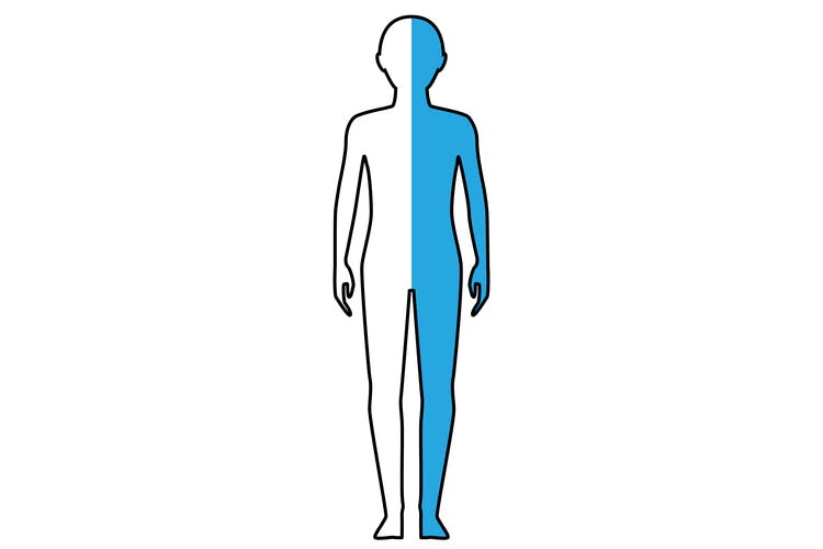 outline of body with right side highlighted to illustrate right hemiplegia