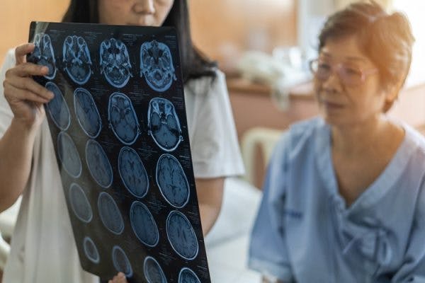 doctor holding brain scan for moderate brain injury survivor