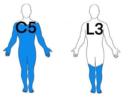 illustration of a C5 vs. L3 spinal cord injury