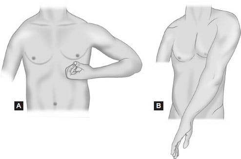 illustration of upper extremity synergistic movement