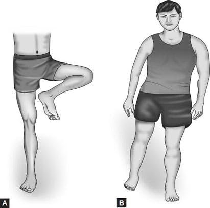 flexion synergy pattern after stroke