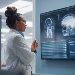 doctor analyzing brain scan of ACA stroke in hospital