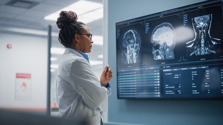 doctor analyzing brain scan of ACA stroke in hospital