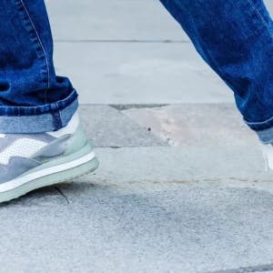 woman showing the early signs of foot drop